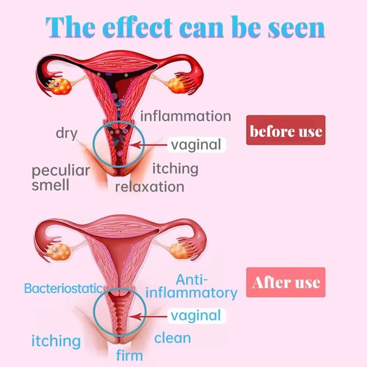 Female Anti-Bacterial Shrink Vagina Nourish